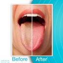 DrTung's Stainless Steel Tongue Cleaner