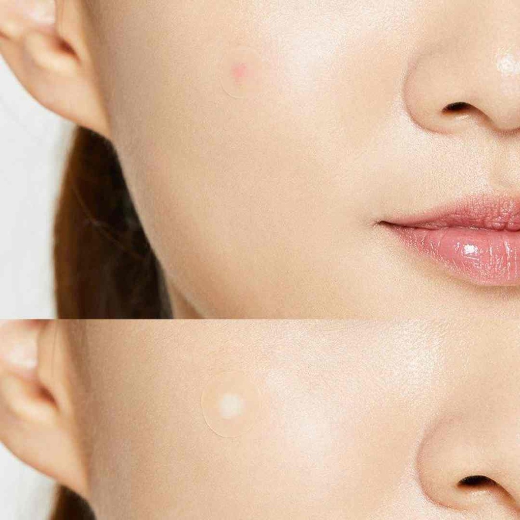 COSRX Acne Pimple Master Patch 24ct