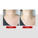 Medi-Peel Collagen Naite Thread Neck Cream Premium 2.0 100ml